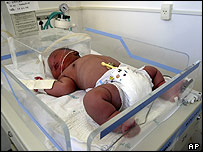 Noworodek o wadze 7,6 kg