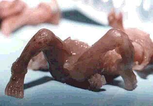 Przeciwko aborcji